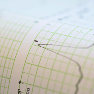 Curs ECG: Electrocardiografia clínica